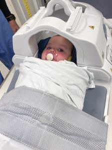 Infant Lucy Landman undergoes a brain scan, one of numerous tests performed at Stanford's Lucile Packard Children's Hospital in March 2022.
